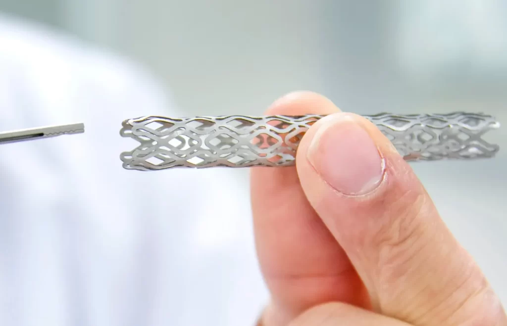 استنت گذاری