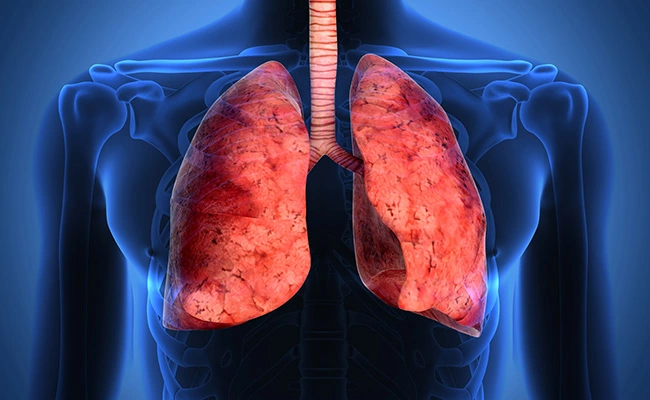 تفاوت فیبروز ریه با سرطان ریه