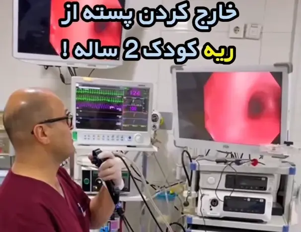 خارج کردن پسته از ریه کودک ۲ ساله