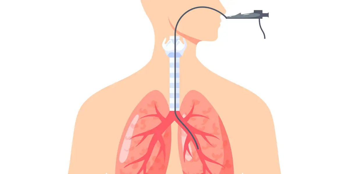 برونکوسکوپی انعطافپذیر