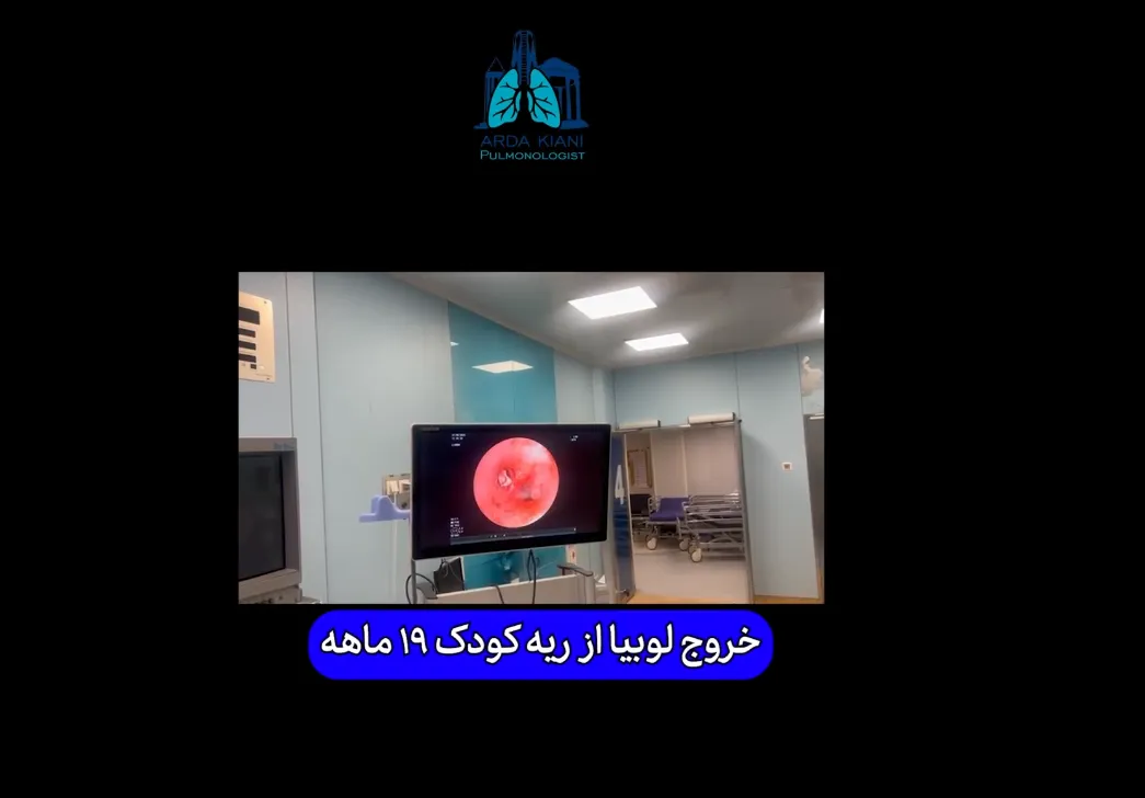 ویدئو: خروج لوبیا از ریه کودک ۱۹ ماهه