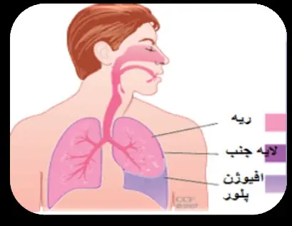 پلورودزیس یا چسباندن پرده جنب بهترین پزشکان ریه در ایران آردا کیانی